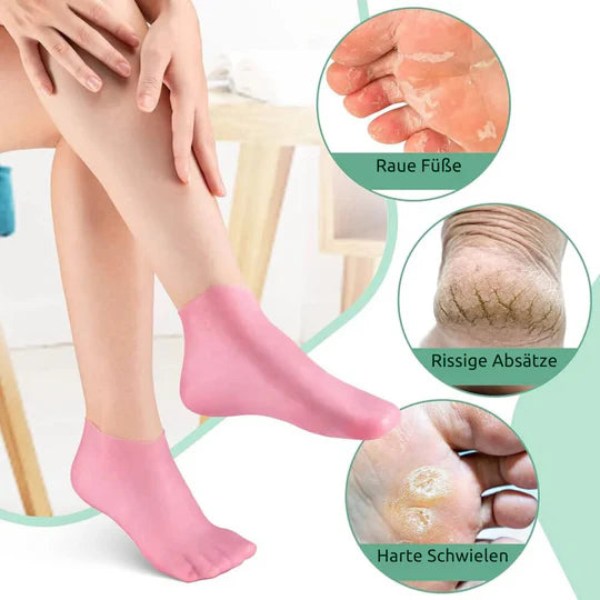 HealSocks™ | Gesunde, glatte Füße!